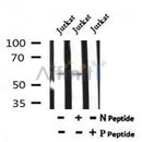 AF7194 at 1/100 staining mouse lung tissue sections by IHC-P. The tissue was formaldehyde fixed and a heat mediated antigen retrieval step in citrate buffer was performed. The tissue was then blocked and incubated with the antibody for 1.5 hours at 22¡ãC. An HRP conjugated goat anti-rabbit antibody was used as the secondary