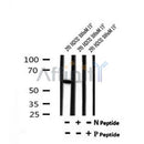 AF7197 at 1/100 staining mouse lung tissue sections by IHC-P. The tissue was formaldehyde fixed and a heat mediated antigen retrieval step in citrate buffer was performed. The tissue was then blocked and incubated with the antibody for 1.5 hours at 22¡ãC. An HRP conjugated goat anti-rabbit antibody was used as the secondary