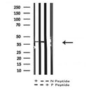 AF7246 at 1/100 staining human kidney tissue sections by IHC-P. The tissue was formaldehyde fixed and a heat mediated antigen retrieval step in citrate buffer was performed. The tissue was then blocked and incubated with the antibody for 1.5 hours at 22¡ãC. An HRP conjugated goat anti-rabbit antibody was used as the secondary