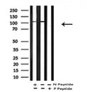 AF7280 at 1/100 staining rat lung tissue sections by IHC-P. The tissue was formaldehyde fixed and a heat mediated antigen retrieval step in citrate buffer was performed. The tissue was then blocked and incubated with the antibody for 1.5 hours at 22¡ãC. An HRP conjugated goat anti-rabbit antibody was used as the secondary