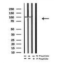 AF7282 at 1/100 staining mouse lung tissue sections by IHC-P. The tissue was formaldehyde fixed and a heat mediated antigen retrieval step in citrate buffer was performed. The tissue was then blocked and incubated with the antibody for 1.5 hours at 22¡ãC. An HRP conjugated goat anti-rabbit antibody was used as the secondary