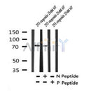 AF7291 at 1/100 staining human gastric cancer tissue sections by IHC-P. The tissue was formaldehyde fixed and a heat mediated antigen retrieval step in citrate buffer was performed. The tissue was then blocked and incubated with the antibody for 1.5 hours at 22¡ãC. An HRP conjugated goat anti-rabbit antibody was used as the secondary
