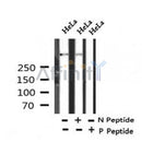 AF7303 at 1/100 staining human gastric cancer tissue sections by IHC-P. The tissue was formaldehyde fixed and a heat mediated antigen retrieval step in citrate buffer was performed. The tissue was then blocked and incubated with the antibody for 1.5 hours at 22¡ãC. An HRP conjugated goat anti-rabbit antibody was used as the secondary