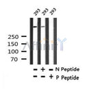 AF7317 at 1/100 staining human spleen tissue sections by IHC-P. The tissue was formaldehyde fixed and a heat mediated antigen retrieval step in citrate buffer was performed. The tissue was then blocked and incubated with the antibody for 1.5 hours at 22¡ãC. An HRP conjugated goat anti-rabbit antibody was used as the secondary