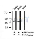 AF7392 at 1/100 staining human liver tissue sections by IHC-P. The tissue was formaldehyde fixed and a heat mediated antigen retrieval step in citrate buffer was performed. The tissue was then blocked and incubated with the antibody for 1.5 hours at 22¡ãC. An HRP conjugated goat anti-rabbit antibody was used as the secondary