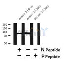Western blot analysis of extracts of mouse kidney? tissue sample,using Phospho-Nephrin(Ser432) Antibody?.