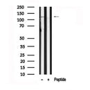 Western blot analysis of GLI1 in lysates of PC-3, using GLI1 Antibody(AF7571).