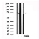 Western blot analysis of PDK1 in lysates of HepG2?, using PDK1 Antibody(AF7615).