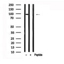 Western blot analysis of FoxO3a in lysates of Jurkat?, using FoxO3a Antibody(AF7624).