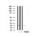 Western blot analysis of CRYAB in lysates of HepG2 , using CRYAB Antibody(AF7676).