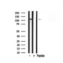 Western blot analysis of PLD1 in lysates of HepG2?, using PLD1 Antibody(AF7871).