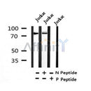 Western blot analysis of Phospho-P2X7(Ser390) in lysates of Jurkat?, using Phospho-P2X7(Ser390) Antibody(AF4326).