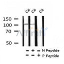Western blot analysis of Phospho-alpha-Actinin (Tyr193) in lysates of C6, using Phospho-alpha-Actinin (Tyr193) Antibody(AF4329).