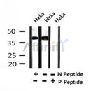 Western blot analysis of Phospho-TOB1 (Ser164) in lysates of HeLa?, using Phospho-TOB1 (Ser164) Antibody(AF4439).