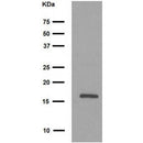 AF4650 staining Hela by IF/ICC. The sample were fixed with PFA and permeabilized in 0.1% Triton X-100,then blocked in 10% serum for 45 minutes at 25¡ãC. The primary antibody was diluted at 1/200 and incubated with the sample for 1 hour at 37¡ãC. An Alexa Fluor 594 conjugated goat anti-rabbit IgG (H+L) Ab, diluted at 1/600, was used as the secondary antibod