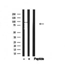 Western blot analysis of IREB1 in lysates of HeLa, using IREB1 Antibody(AF4711).