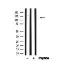 Western blot analysis of Ras-GRF1 in lysates of Human hippocampus, using Ras-GRF1 Antibody(AF4714).