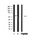 Western blot analysis of KOR-1 in lysates of Mouse brain, using KOR-1 Antibody(AF4719).