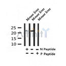 Western blot analysis of Acetyl-SOD2/MnSOD (K122) in lysates of Mouse liver, using Acetyl-SOD2/MnSOD (K122) Antibody(AF4360).