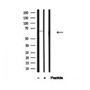 Western blot analysis of IRAK2 in lysates of Jurkat, using IRAK2 Antibody(AF4676).