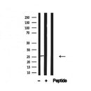 Western blot analysis of Bcl-2 in lysates of Jurkat, using Bcl-2 Antibody(AF4700).