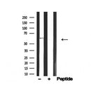 Western blot analysis of Src in lysates of MCF7?, using Src Antibody(AF4704).