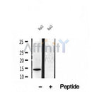 DF12038 at 1/100 staining Mouse colon tissue by IHC-P. The sample was formaldehyde fixed and a heat mediated antigen retrieval step in citrate buffer was performed. The sample was then blocked and incubated with the antibody for 1.5 hours at 22¡ãC. An HRP conjugated goat anti-rabbit antibody was used as the secondary