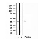 DF12080 staining HepG2 by IF/ICC. The sample were fixed with PFA and permeabilized in 0.1% Triton X-100,then blocked in 10% serum for 45 minutes at 25¡ãC. The primary antibody was diluted at 1/200 and incubated with the sample for 1 hour at 37¡ãC. An Alexa Fluor 594 conjugated goat anti-rabbit IgG (H+L) Ab, diluted at 1/600, was used as the secondary antibod