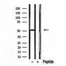 Western blot analysis of extracts from B16F10, using EDIL3 antibody. Lane 1 was treated with the blocking peptide.