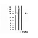 DF12181 at 1/100 staining Human lung tissue by IHC-P. The sample was formaldehyde fixed and a heat mediated antigen retrieval step in citrate buffer was performed. The sample was then blocked and incubated with the antibody for 1.5 hours at 22¡ãC. An HRP conjugated goat anti-rabbit antibody was used as the secondary