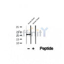 DF12259 at 1/100 staining Human lymph cancer tissue by IHC-P. The sample was formaldehyde fixed and a heat mediated antigen retrieval step in citrate buffer was performed. The sample was then blocked and incubated with the antibody for 1.5 hours at 22¡ãC. An HRP conjugated goat anti-rabbit antibody was used as the secondary