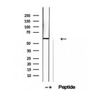 Western blot analysis of extracts from Sp2/0, using KIF12 Antibody. Lane 1 was treated with the blocking peptide.