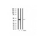 Western blot analysis of extracts from HepG2, using IkappaB-alpha Antibody. Lane 1 was treated with the blocking peptide.