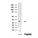 Western blot analysis of extracts from hepg2, using ETFA antibody. Lane 1 was treated with the blocking peptide.
