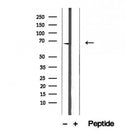 DF12395 staining Hela by IF/ICC. The sample were fixed with PFA and permeabilized in 0.1% Triton X-100,then blocked in 10% serum for 45 minutes at 25¡ãC. The primary antibody was diluted at 1/200 and incubated with the sample for 1 hour at 37¡ãC. An Alexa Fluor 594 conjugated goat anti-rabbit IgG (H+L) Ab, diluted at 1/600, was used as the secondary antibod