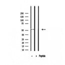 Western blot analysis of extracts from Pc12, using SHMT1 Antibody. The lane on the left was treated with blocking peptide.
