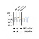 AF2314 at 1/100 staining Human thyroid cancer tissue by IHC-P. The sample was formaldehyde fixed and a heat mediated antigen retrieval step in citrate buffer was performed. The sample was then blocked and incubated with the antibody for 1.5 hours at 22¡ãC. An HRP conjugated goat anti-rabbit antibody was used as the secondary