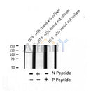 AF2337 at 1/100 staining Human breast cancer tissue by IHC-P. The sample was formaldehyde fixed and a heat mediated antigen retrieval step in citrate buffer was performed. The sample was then blocked and incubated with the antibody for 1.5 hours at 22¡ãC. An HRP conjugated goat anti-rabbit antibody was used as the secondary