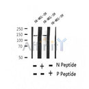 AF2370 at 1/100 staining Human thyroid cancer tissue by IHC-P. The sample was formaldehyde fixed and a heat mediated antigen retrieval step in citrate buffer was performed. The sample was then blocked and incubated with the antibody for 1.5 hours at 22¡ãC. An HRP conjugated goat anti-rabbit antibody was used as the secondary