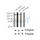 AF2371 at 1/100 staining Human thyroid cancer tissue by IHC-P. The sample was formaldehyde fixed and a heat mediated antigen retrieval step in citrate buffer was performed. The sample was then blocked and incubated with the antibody for 1.5 hours at 22¡ãC. An HRP conjugated goat anti-rabbit antibody was used as the secondary