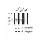 AF2376 at 1/100 staining Human thyroid cancer tissue by IHC-P. The sample was formaldehyde fixed and a heat mediated antigen retrieval step in citrate buffer was performed. The sample was then blocked and incubated with the antibody for 1.5 hours at 22¡ãC. An HRP conjugated goat anti-rabbit antibody was used as the secondary