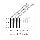 AF2377 at 1/100 staining Human breast cancer tissue by IHC-P. The sample was formaldehyde fixed and a heat mediated antigen retrieval step in citrate buffer was performed. The sample was then blocked and incubated with the antibody for 1.5 hours at 22¡ãC. An HRP conjugated goat anti-rabbit antibody was used as the secondary