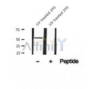 AF2378 at 1/100 staining Human breast cancer tissue by IHC-P. The sample was formaldehyde fixed and a heat mediated antigen retrieval step in citrate buffer was performed. The sample was then blocked and incubated with the antibody for 1.5 hours at 22¡ãC. An HRP conjugated goat anti-rabbit antibody was used as the secondary