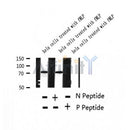 AF2380 at 1/100 staining Human thyroid cancer tissue by IHC-P. The sample was formaldehyde fixed and a heat mediated antigen retrieval step in citrate buffer was performed. The sample was then blocked and incubated with the antibody for 1.5 hours at 22¡ãC. An HRP conjugated goat anti-rabbit antibody was used as the secondary