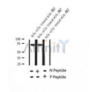 AF2381 at 1/100 staining Human breast cancer tissue by IHC-P. The sample was formaldehyde fixed and a heat mediated antigen retrieval step in citrate buffer was performed. The sample was then blocked and incubated with the antibody for 1.5 hours at 22¡ãC. An HRP conjugated goat anti-rabbit antibody was used as the secondary