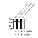 AF2382 at 1/100 staining Human thyroid cancer tissue by IHC-P. The sample was formaldehyde fixed and a heat mediated antigen retrieval step in citrate buffer was performed. The sample was then blocked and incubated with the antibody for 1.5 hours at 22¡ãC. An HRP conjugated goat anti-rabbit antibody was used as the secondary