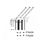 AF2383 at 1/100 staining Human thyroid cancer tissue by IHC-P. The sample was formaldehyde fixed and a heat mediated antigen retrieval step in citrate buffer was performed. The sample was then blocked and incubated with the antibody for 1.5 hours at 22¡ãC. An HRP conjugated goat anti-rabbit antibody was used as the secondary