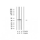 AF2387 at 1/100 staining Human thyroid cancer tissue by IHC-P. The sample was formaldehyde fixed and a heat mediated antigen retrieval step in citrate buffer was performed. The sample was then blocked and incubated with the antibody for 1.5 hours at 22¡ãC. An HRP conjugated goat anti-rabbit antibody was used as the secondary