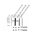 AF2389 at 1/100 staining Human thyroid cancer tissue by IHC-P. The sample was formaldehyde fixed and a heat mediated antigen retrieval step in citrate buffer was performed. The sample was then blocked and incubated with the antibody for 1.5 hours at 22¡ãC. An HRP conjugated goat anti-rabbit antibody was used as the secondary