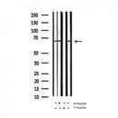 AF3393 staining HeLa by IF/ICC. The sample were fixed with PFA and permeabilized in 0.1% Triton X-100,then blocked in 10% serum for 45 minutes at 25¡ãC. The primary antibody was diluted at 1/200 and incubated with the sample for 1 hour at 37¡ãC. An Alexa Fluor 594 conjugated goat anti-rabbit IgG (H+L) Ab, diluted at 1/600, was used as the secondary antibod